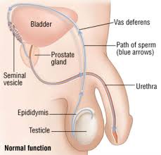 Male Infertility Treatment