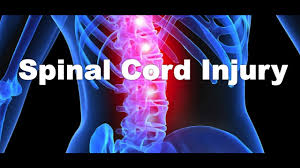 Spinal cord Injury Treatment