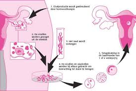 In Vitro Maturation Treatment