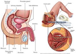 Robotic Prostate Cancer Surgery