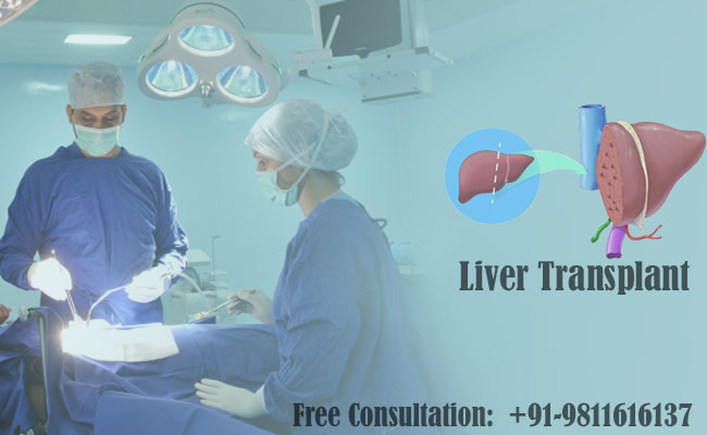 Liver Transplant