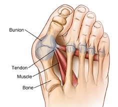 Ligaments Repair Surgery