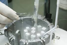 Sperm Cryopreservation or Sperm Freezing