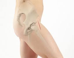 Partial Hip Replacement Surgery