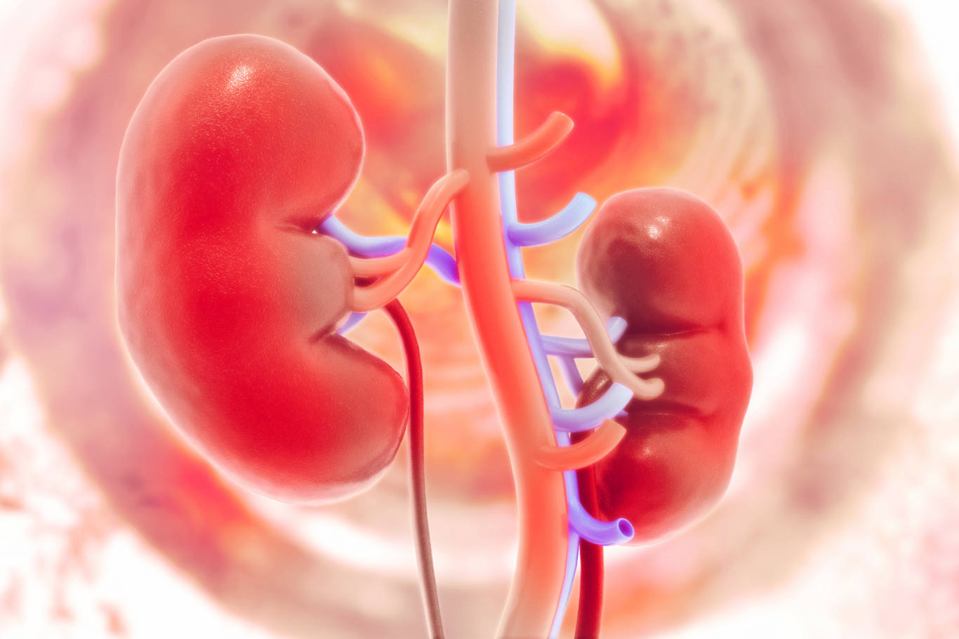 Diabetic Kidney Disorder