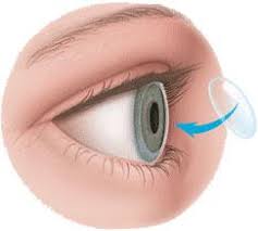 Corneal Transplant Surgery