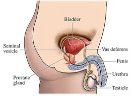 Male Hypospadias