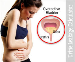 Female Urinary Incontinence